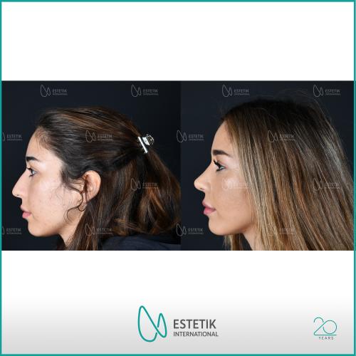 Before after photos of our patients 6
